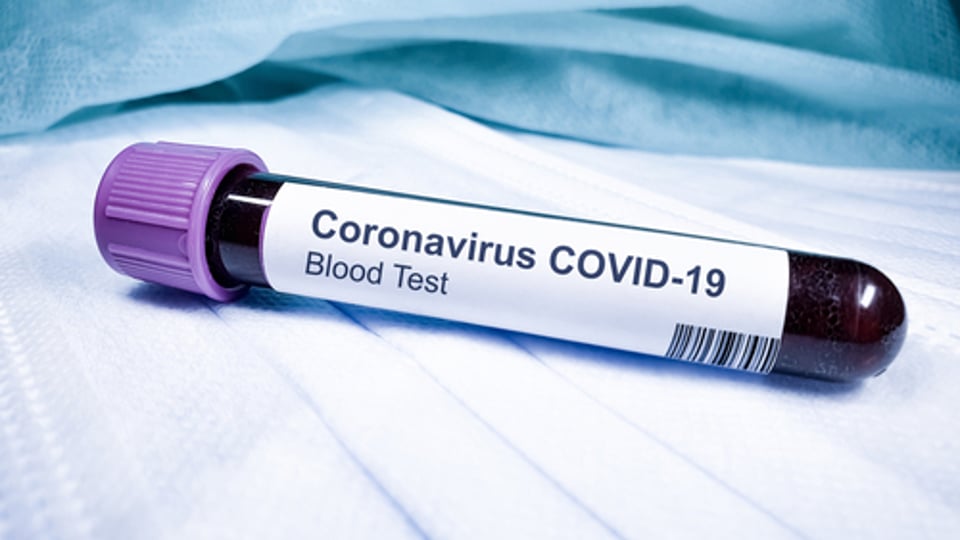 Government Urged To Offer Landlords Coronavirus Guidance